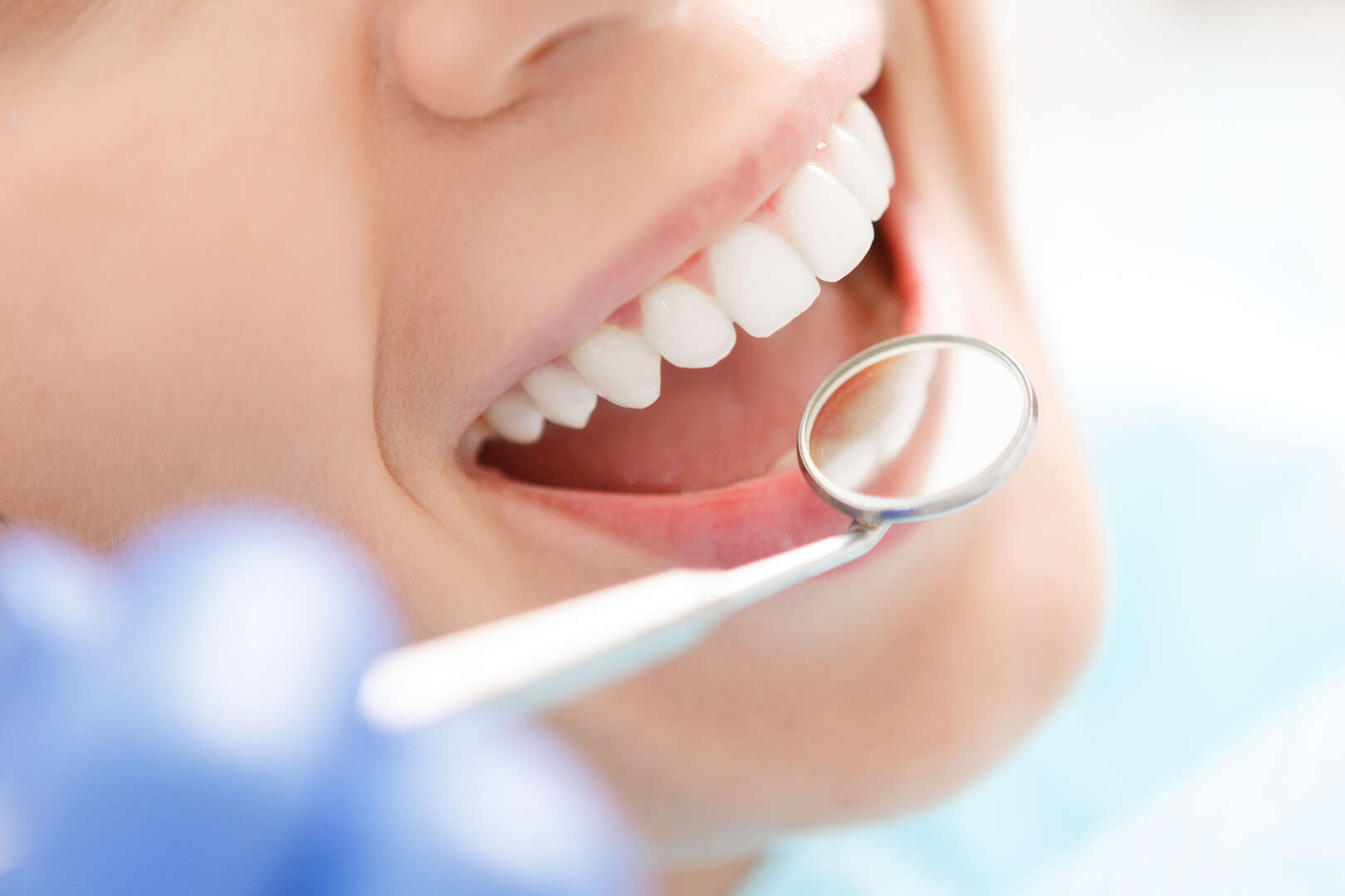 Come scegliere il dentista in Italia senza farsi abbagliare dai low cost!