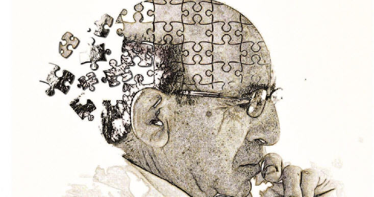 Scoperta rivoluzionaria nel trattamento dell’Alzheimer
